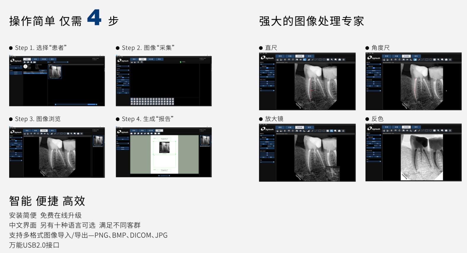 口内传感器详情2.png