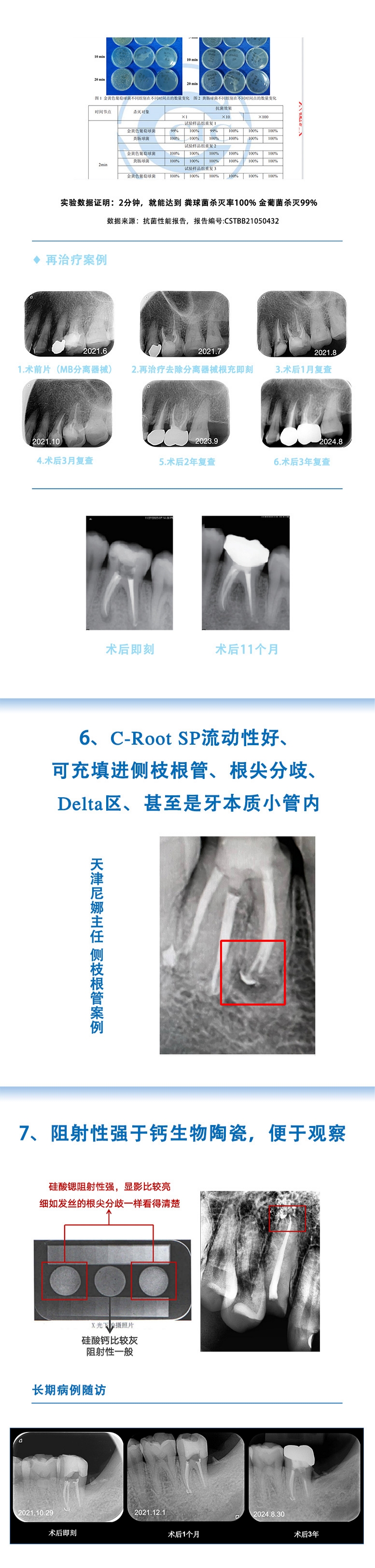 充填糊剂详情2.jpg