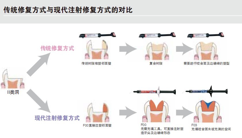 加强型流动树脂详情2.jpg